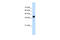 Squalene Epoxidase antibody, 29-697, ProSci, Western Blot image 