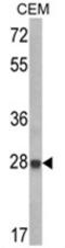 Insulin Like Growth Factor Binding Protein 6 antibody, AP17495PU-N, Origene, Western Blot image 