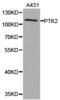 Protein Tyrosine Kinase 2 antibody, LS-C193067, Lifespan Biosciences, Western Blot image 