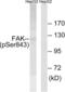 Protein Tyrosine Kinase 2 antibody, LS-C198948, Lifespan Biosciences, Western Blot image 