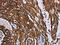 Lysyl-TRNA Synthetase antibody, CSB-PA163096, Cusabio, Immunohistochemistry paraffin image 