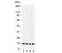 Stefin-B antibody, R31218, NSJ Bioreagents, Western Blot image 