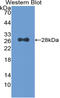 Cyclin Dependent Kinase 9 antibody, LS-C373962, Lifespan Biosciences, Western Blot image 