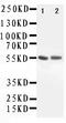 Aldehyde Dehydrogenase 1 Family Member A1 antibody, PA1671, Boster Biological Technology, Western Blot image 