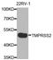 Transmembrane Serine Protease 2 antibody, A1979, ABclonal Technology, Western Blot image 