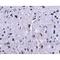Programmed Cell Death 1 antibody, NBP1-75518, Novus Biologicals, Immunohistochemistry frozen image 