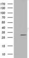 LRAT Domain Containing 2 antibody, NBP2-02956, Novus Biologicals, Western Blot image 