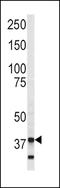 Annexin A5 antibody, LS-C99311, Lifespan Biosciences, Western Blot image 
