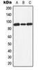 Dishevelled Segment Polarity Protein 3 antibody, MBS821860, MyBioSource, Western Blot image 