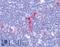 CD1a Molecule antibody, LS-B3429, Lifespan Biosciences, Immunohistochemistry frozen image 