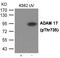 TACE antibody, GTX55420, GeneTex, Western Blot image 