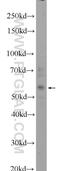 Zinc Finger Protein 2 antibody, 24720-1-AP, Proteintech Group, Western Blot image 