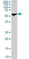 Stress Induced Phosphoprotein 1 antibody, H00010963-M11, Novus Biologicals, Western Blot image 