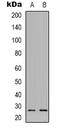 Neurexophilin 3 antibody, LS-C368709, Lifespan Biosciences, Western Blot image 