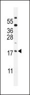 ORMDL Sphingolipid Biosynthesis Regulator 3 antibody, LS-B9583, Lifespan Biosciences, Western Blot image 