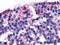 Calcitonin Receptor antibody, orb85883, Biorbyt, Immunohistochemistry paraffin image 