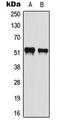 Activating Transcription Factor 2 antibody, LS-C353962, Lifespan Biosciences, Western Blot image 