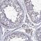 Tetratricopeptide Repeat Domain 23 antibody, PA5-59148, Invitrogen Antibodies, Immunohistochemistry frozen image 