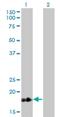 Troponin C1, Slow Skeletal And Cardiac Type antibody, H00007134-M01, Novus Biologicals, Western Blot image 