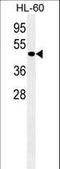 Autophagy Related 4D Cysteine Peptidase antibody, LS-C156603, Lifespan Biosciences, Western Blot image 