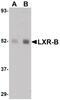 Nuclear Receptor Subfamily 1 Group H Member 2 antibody, PA5-20886, Invitrogen Antibodies, Western Blot image 