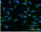 ATP Binding Cassette Subfamily G Member 1 antibody, H00009619-M03, Novus Biologicals, Immunofluorescence image 