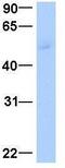 Lymphoid Enhancer Binding Factor 1 antibody, GTX77879, GeneTex, Western Blot image 