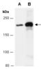Dedicator of cytokinesis protein 5 antibody, R1832-2, Abiocode, Western Blot image 