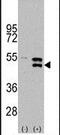 Mitogen-Activated Protein Kinase Kinase 5 antibody, PA5-15083, Invitrogen Antibodies, Western Blot image 