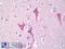 Protein Kinase D1 antibody, LS-B7000, Lifespan Biosciences, Immunohistochemistry paraffin image 