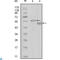 Ephrin type-A receptor 6 antibody, LS-C812454, Lifespan Biosciences, Western Blot image 