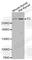 Thyroglobulin antibody, A2607, ABclonal Technology, Western Blot image 