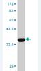 Calcium Homeostasis Endoplasmic Reticulum Protein antibody, H00010523-M02, Novus Biologicals, Western Blot image 