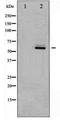 AKT Serine/Threonine Kinase 2 antibody, LS-C417496, Lifespan Biosciences, Western Blot image 