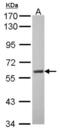 Monoamine Oxidase A antibody, NBP2-19379, Novus Biologicals, Western Blot image 