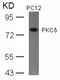 Protein Kinase C Delta antibody, MBS9411568, MyBioSource, Western Blot image 