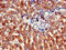 ATP Synthase F1 Subunit Beta antibody, CSB-PA002350EA01HU, Cusabio, Immunohistochemistry paraffin image 