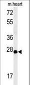 Claudin 4 antibody, LS-C168817, Lifespan Biosciences, Western Blot image 