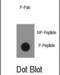 ABL Proto-Oncogene 1, Non-Receptor Tyrosine Kinase antibody, abx031820, Abbexa, Immunohistochemistry frozen image 