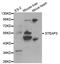 STEAP3 Metalloreductase antibody, LS-B13356, Lifespan Biosciences, Western Blot image 