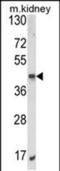 AlkB Homolog 3, Alpha-Ketoglutaratedependent Dioxygenase antibody, PA5-49622, Invitrogen Antibodies, Western Blot image 