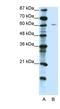 Zinc Finger Protein 286A antibody, NBP1-80345, Novus Biologicals, Western Blot image 