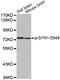 Synapsin I antibody, STJ22427, St John