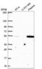 Family With Sequence Similarity 155 Member A antibody, NBP2-55425, Novus Biologicals, Western Blot image 