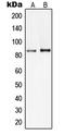 Phosphoinositide-3-Kinase Regulatory Subunit 2 antibody, LS-C352666, Lifespan Biosciences, Western Blot image 