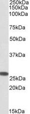 Coiled-Coil-Helix-Coiled-Coil-Helix Domain Containing 3 antibody, GTX88140, GeneTex, Western Blot image 