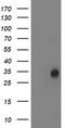 Lactamase Beta 2 antibody, LS-C785776, Lifespan Biosciences, Western Blot image 