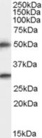 Transmembrane Serine Protease 5 antibody, LS-B10272, Lifespan Biosciences, Western Blot image 