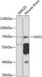 Hyaluronan synthase 2 antibody, 23-964, ProSci, Western Blot image 