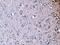 P21 (RAC1) Activated Kinase 3 antibody, A03124-1, Boster Biological Technology, Immunohistochemistry paraffin image 